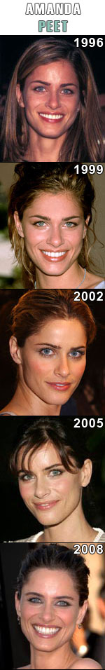 Amanda Peet
