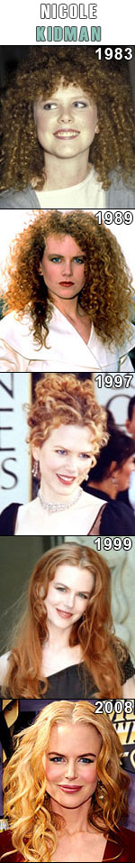 Nicole Kidman